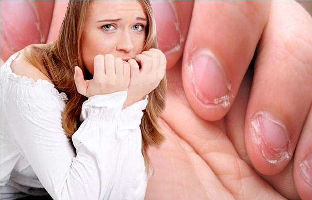Roer unhas é um hábito perigoso nesses tempos de Coronavírus