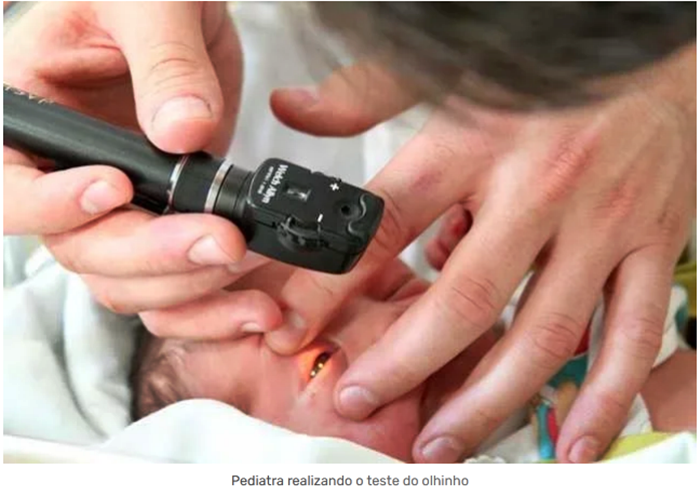 Projeto torna obrigatório o teste do olhinho em bebês nascidos em Pernambuco