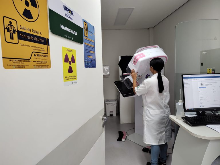 UPAE Escada inicia o ano com oferta de exames de mamografia sem agendamento
