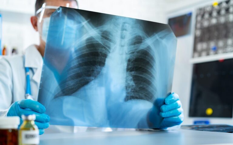 Pesquisa da UFPE convida fumantes e ex-fumantes para avaliação pulmonar gratuita