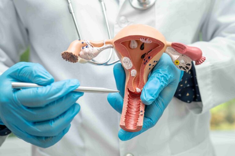 Escada e Primavera dispõem de teste molecular para detecção precoce do câncer do colo do útero pelo SUS